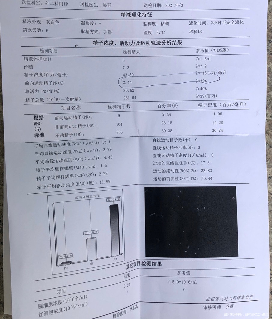老公做的精子常规和B超医生麻烦帮我看看具体结