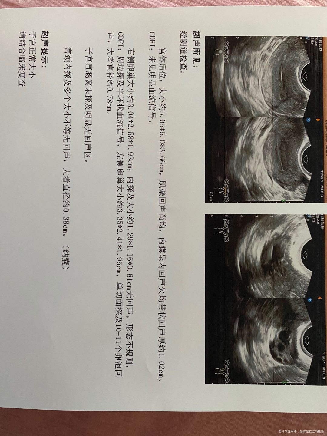 53末次月经65好又试纸强阳是怎么回事做了B