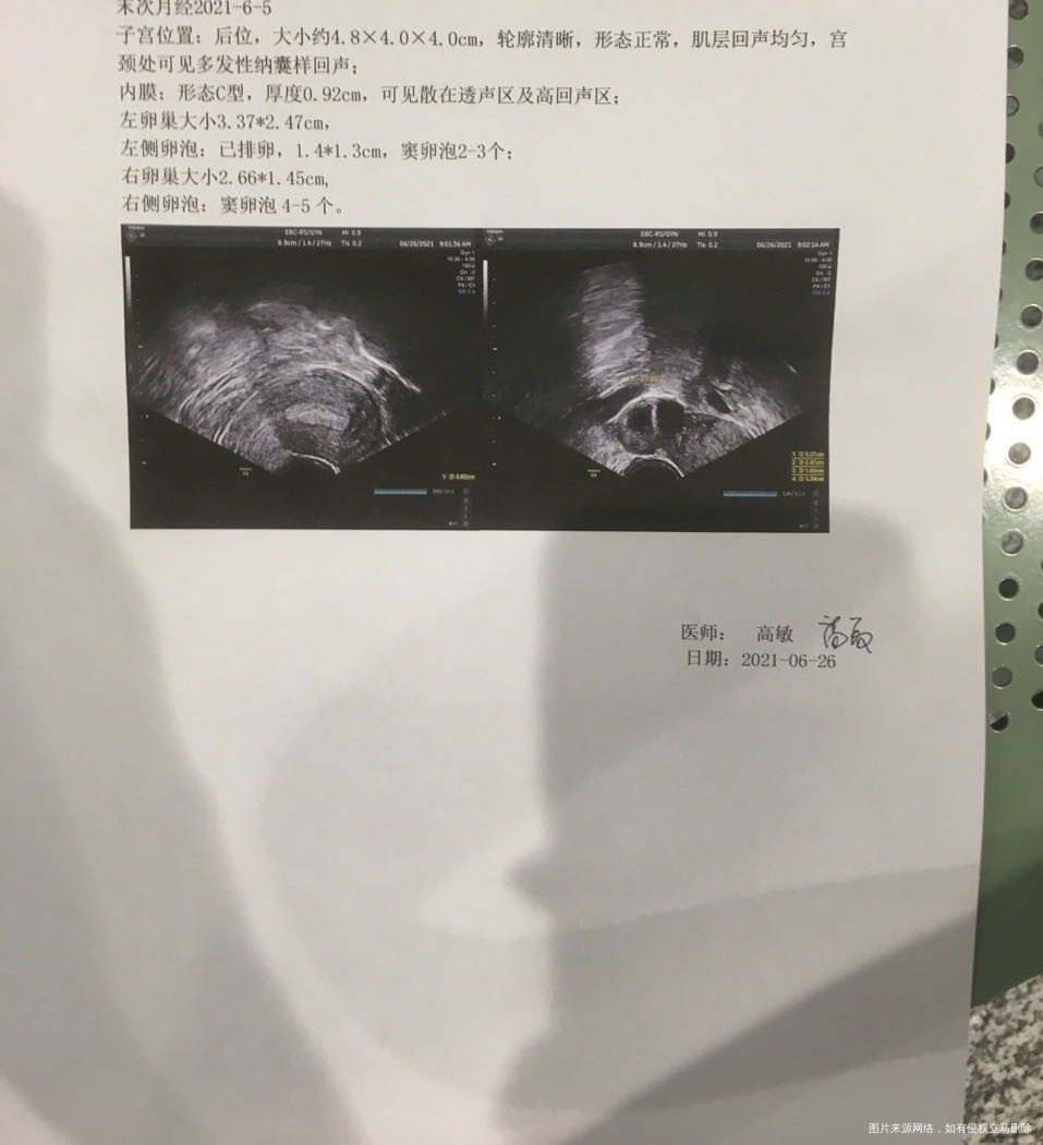 23号打的绒促和醋酸曲普瑞林26号去医院已排