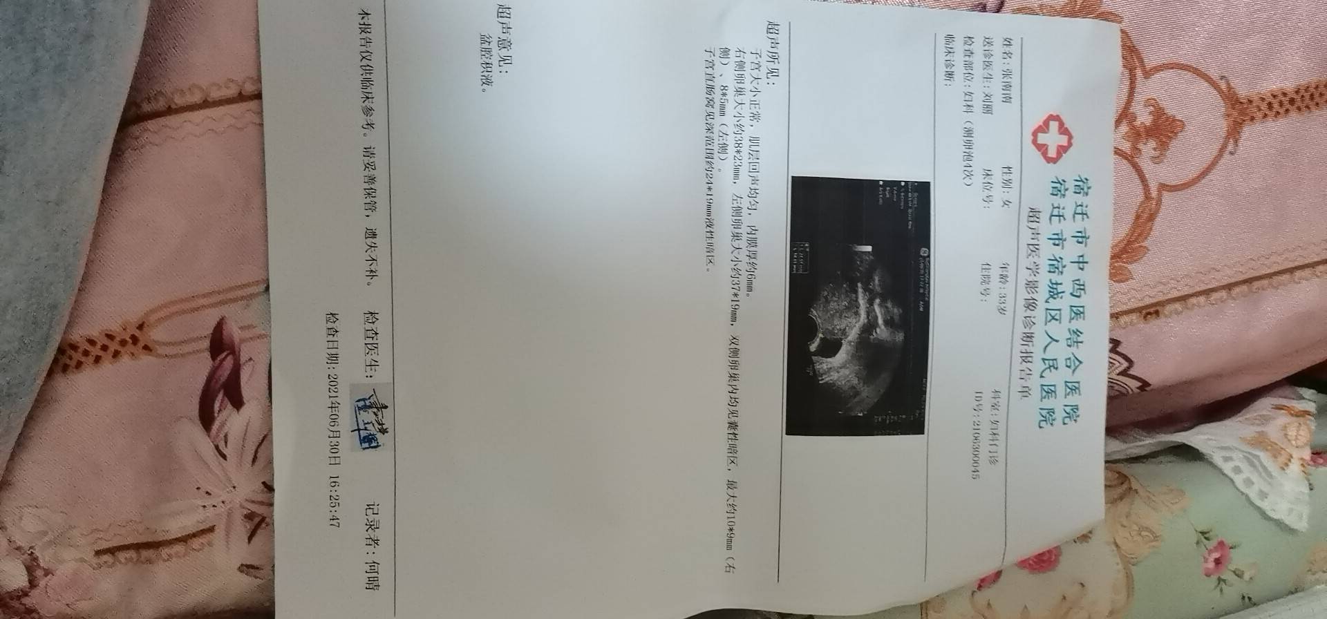 请问这是排过卵了吗盆腔积液用不用治疗