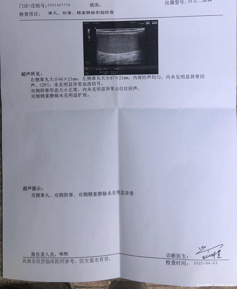 老公做的精子常规和B超医生麻烦帮我看看具体结