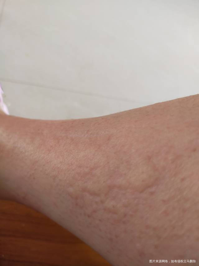 服用补佳乐每天早上4片吃了有十天了前两天身上