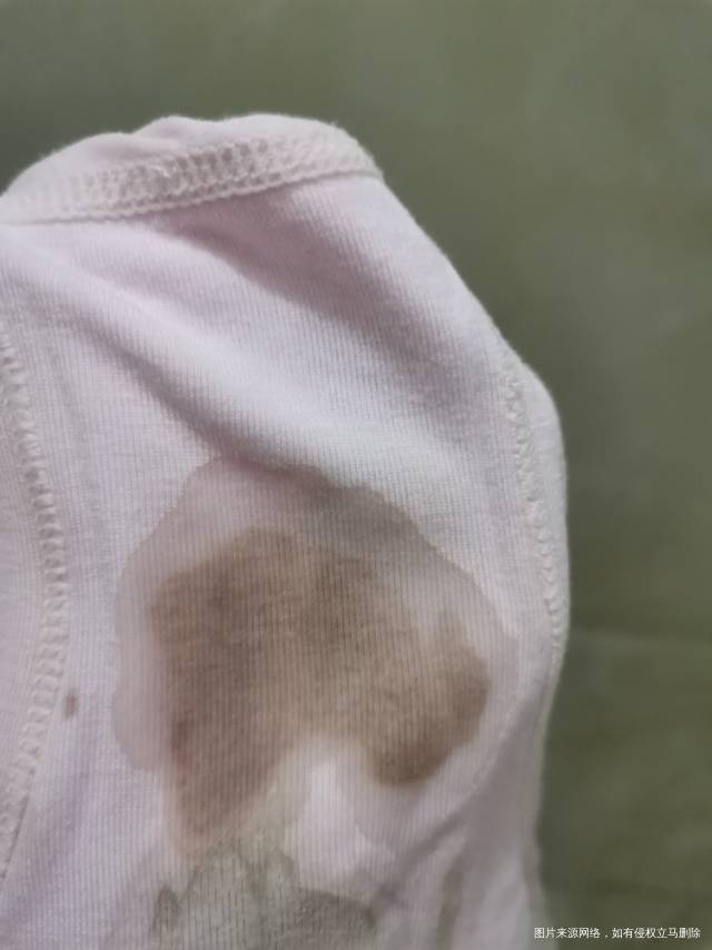 主任这是我移植十四天的血值今早上塞药发现内裤