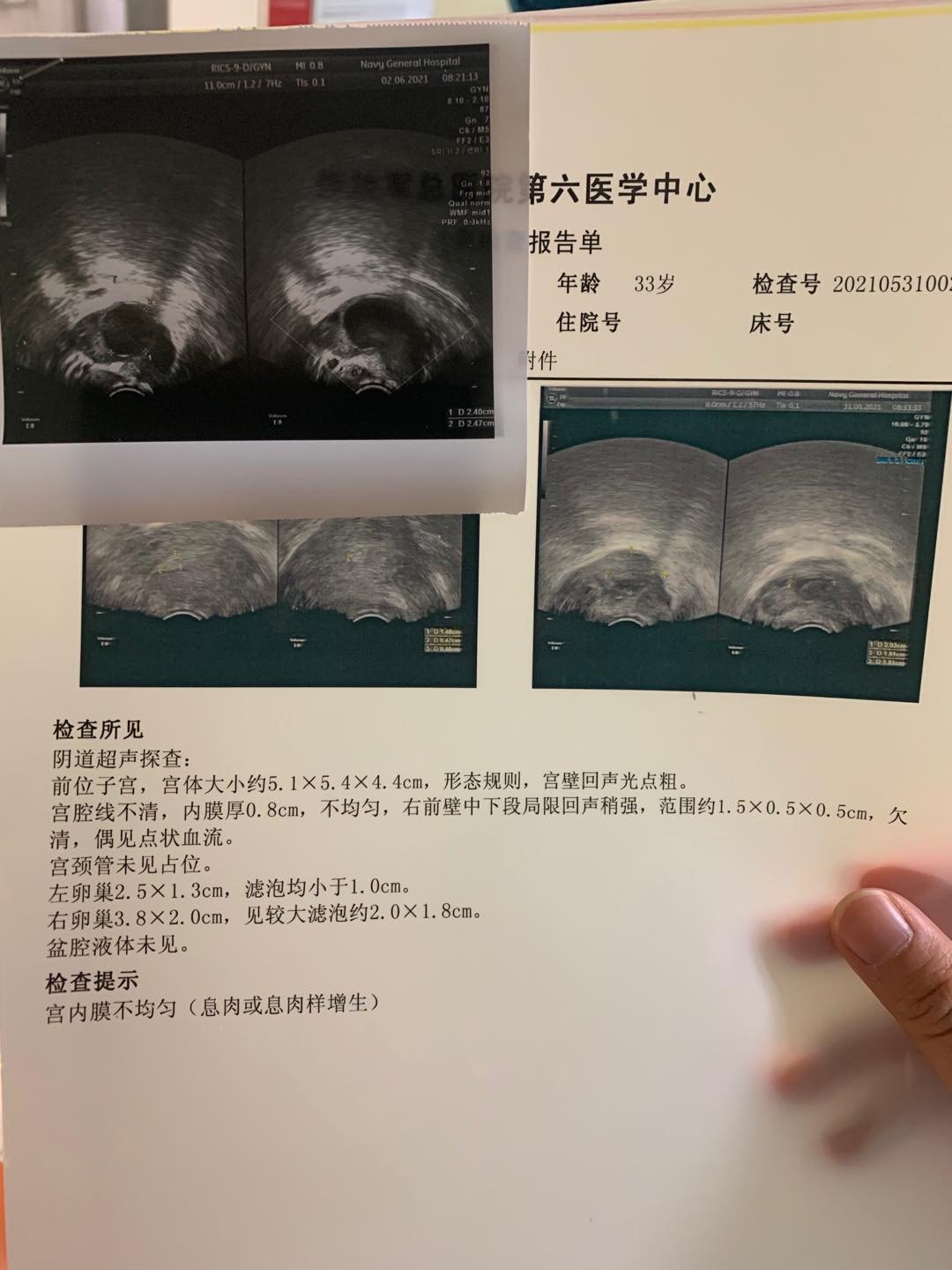 一直黄素化连续三个月破卵针这个月监测又长到2