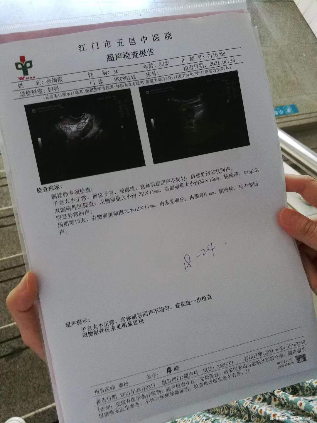 和老婆备孕3个月但没有成功怀孕想请问我们夫妻