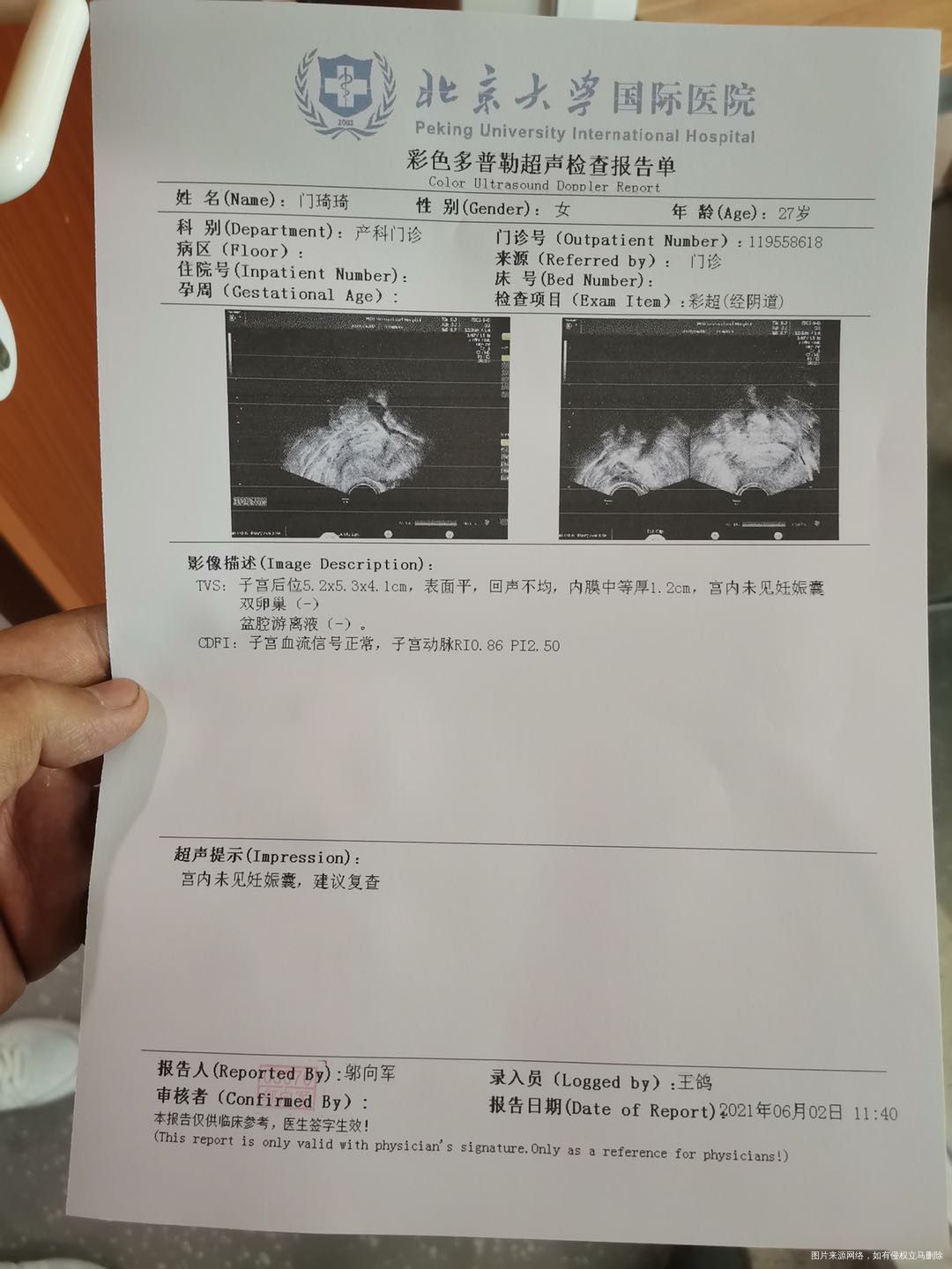 昨天抽血结果是孕酮118hcg160想问下孩