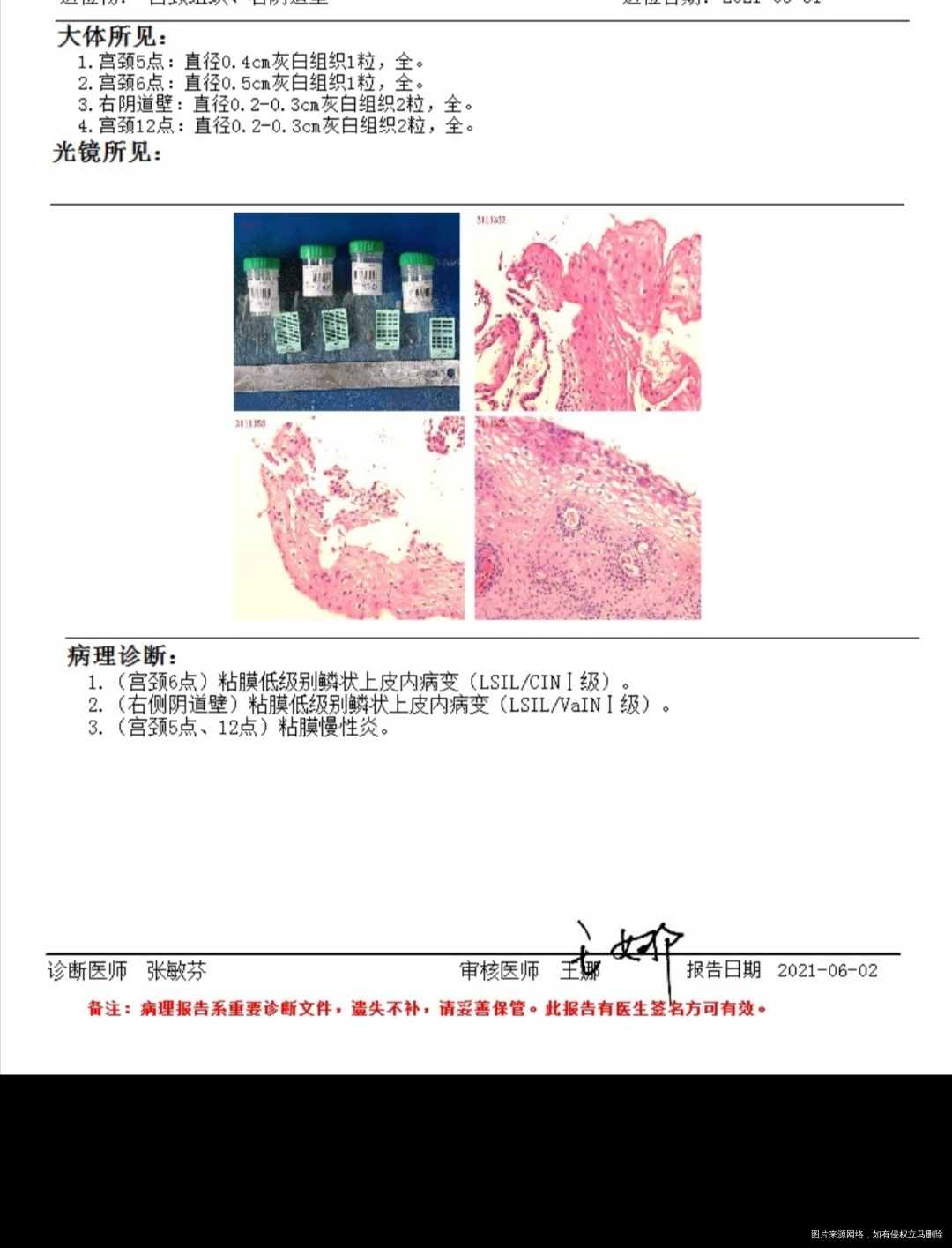 你好这是宫颈检查一项报告请问会影响怀孕吗