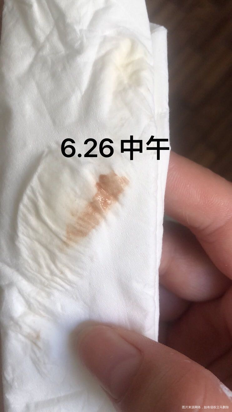 试管移植鲜胚第9天有点粉红色分泌物第十天有褐