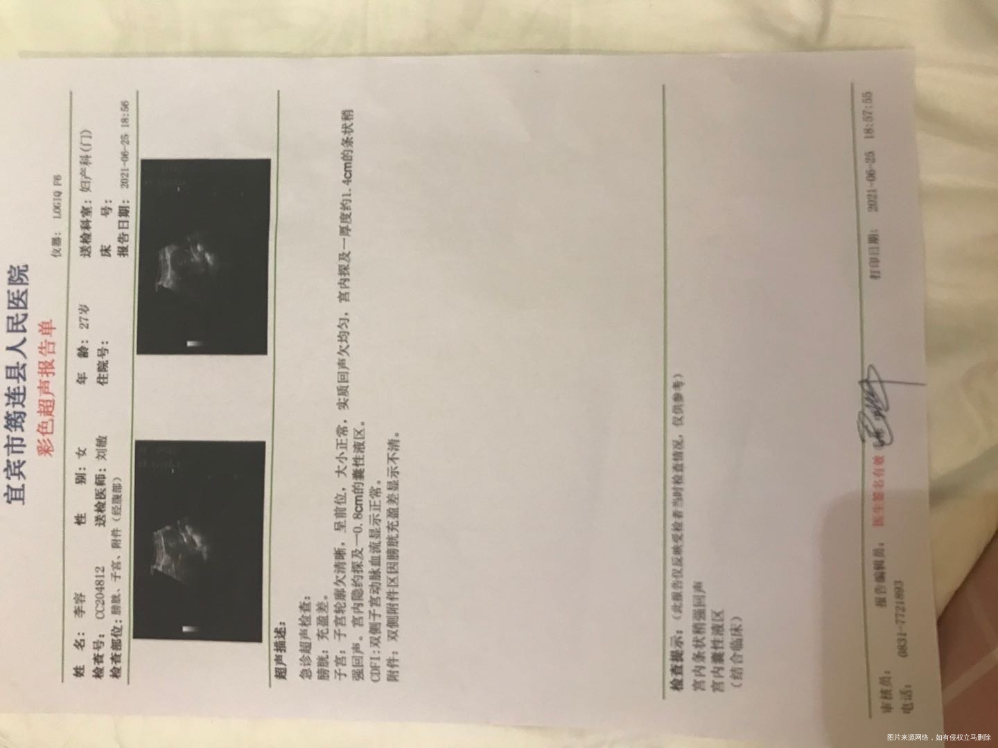 试管移植时间6:9号移植天数19天冻囊胚23
