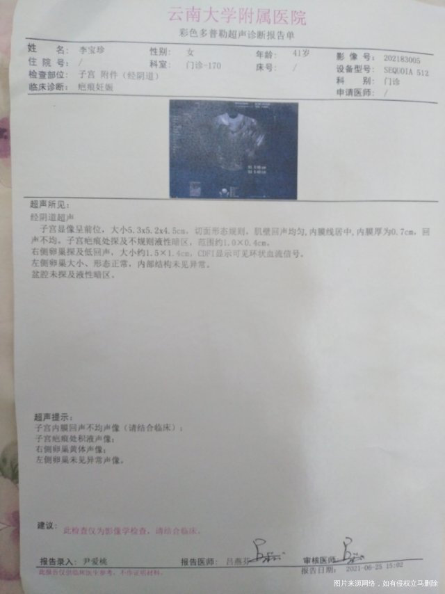 五月二十一号做子宫疤痕妊娠手术后到六月二十五