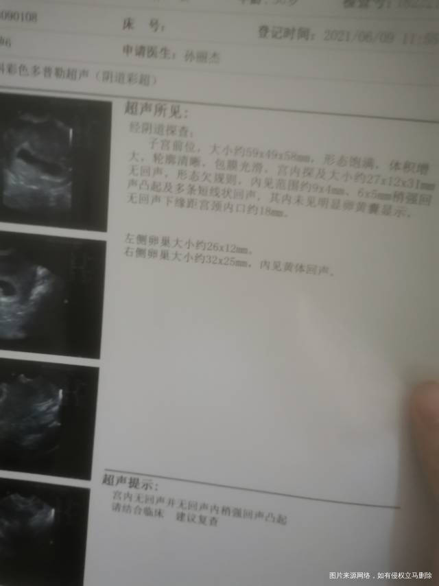 417最后一次月经每月推迟一个星期今天的b超