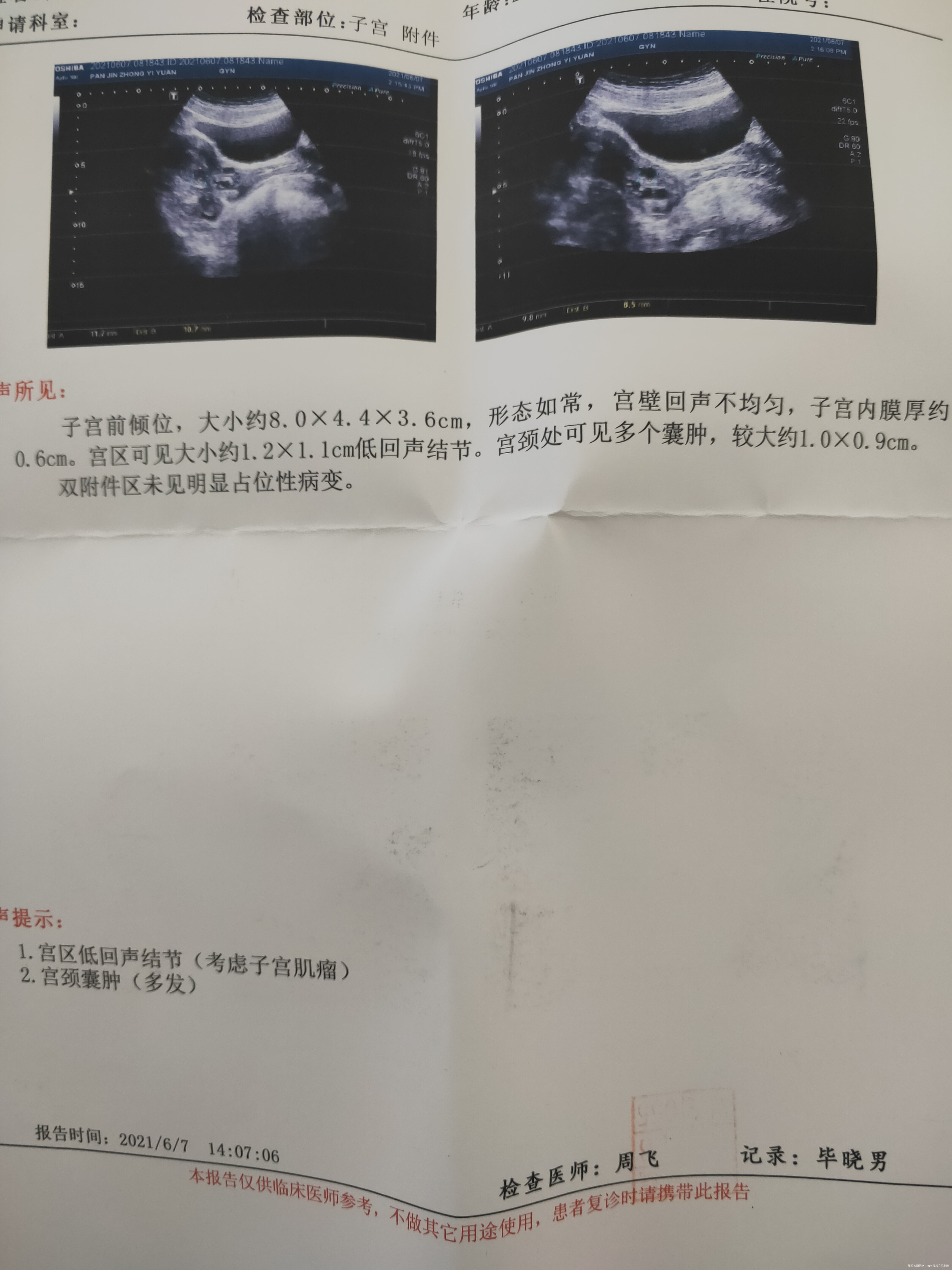 来月经一直淋漓不尽走不干净我该怎么办去医院检