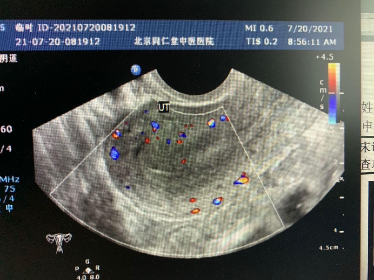 图一图二是7/20日B超检查计划于725日进