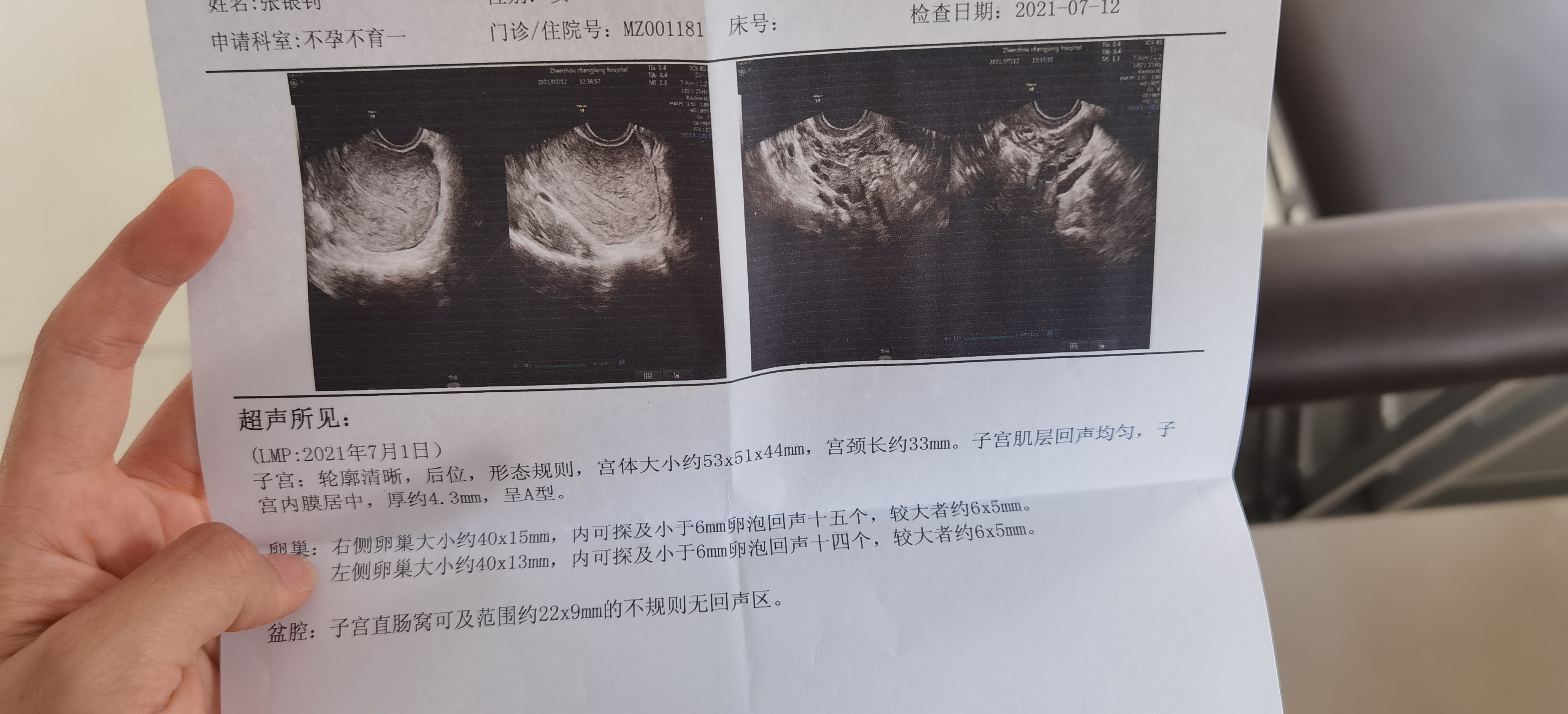 月经第三天性激素六项第12天彩超单和尿检我从