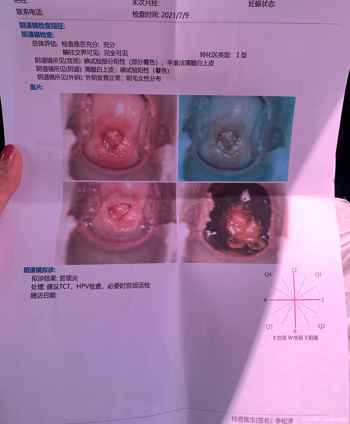 医生您好我今天去做检查得出这个报告问题大吗