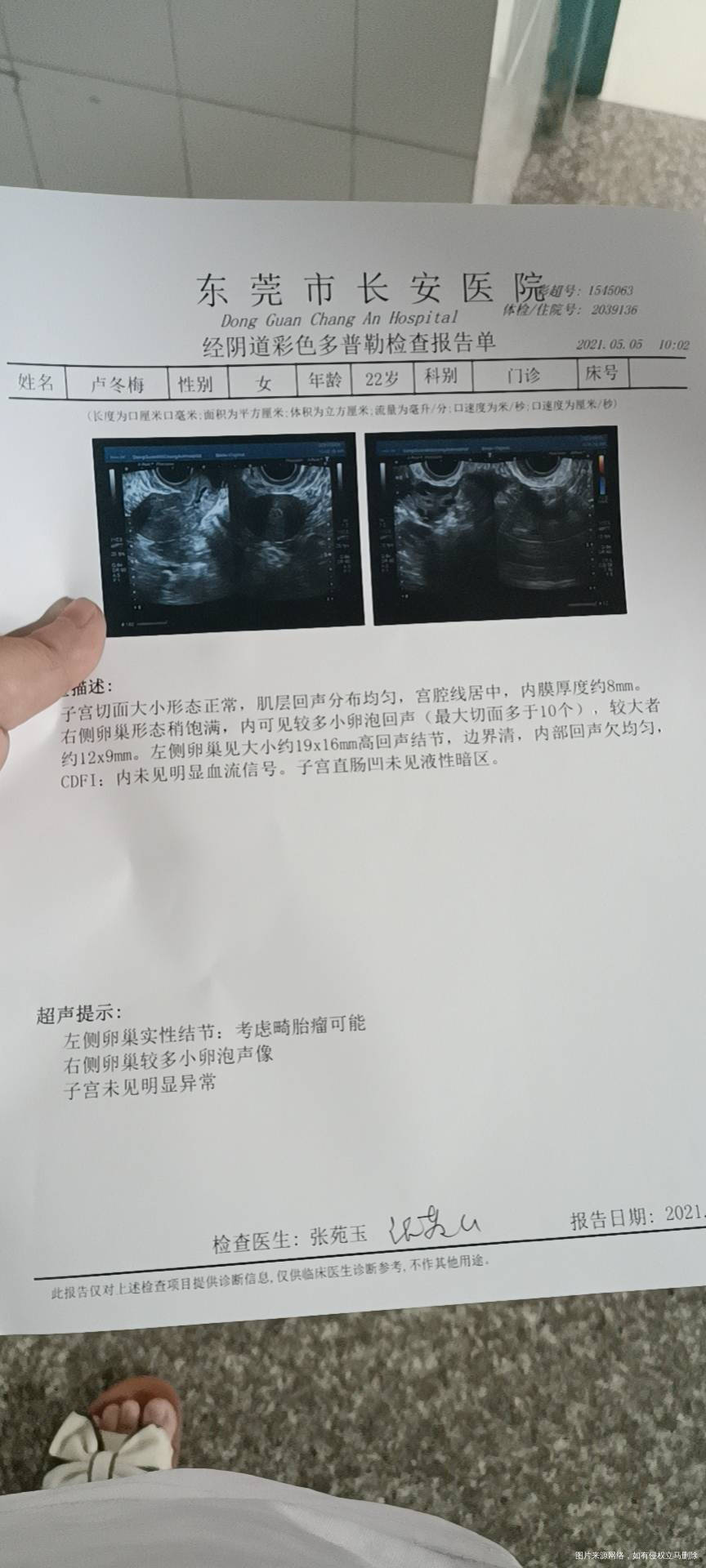 检查结果月经不调卵泡发育不起