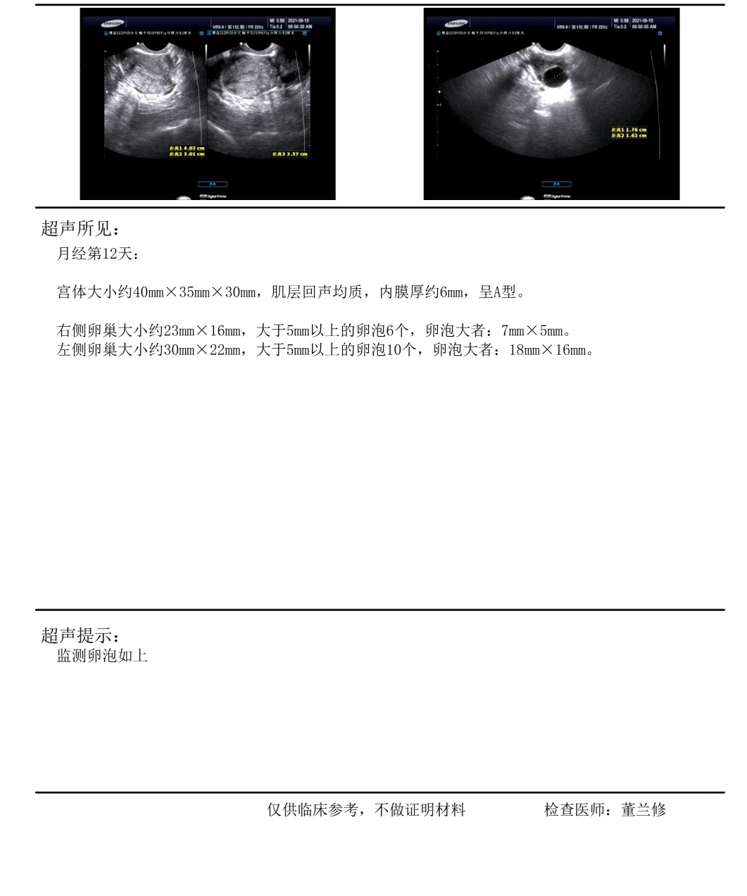 上个月促排内膜6卵泡1816医生让回去同房排