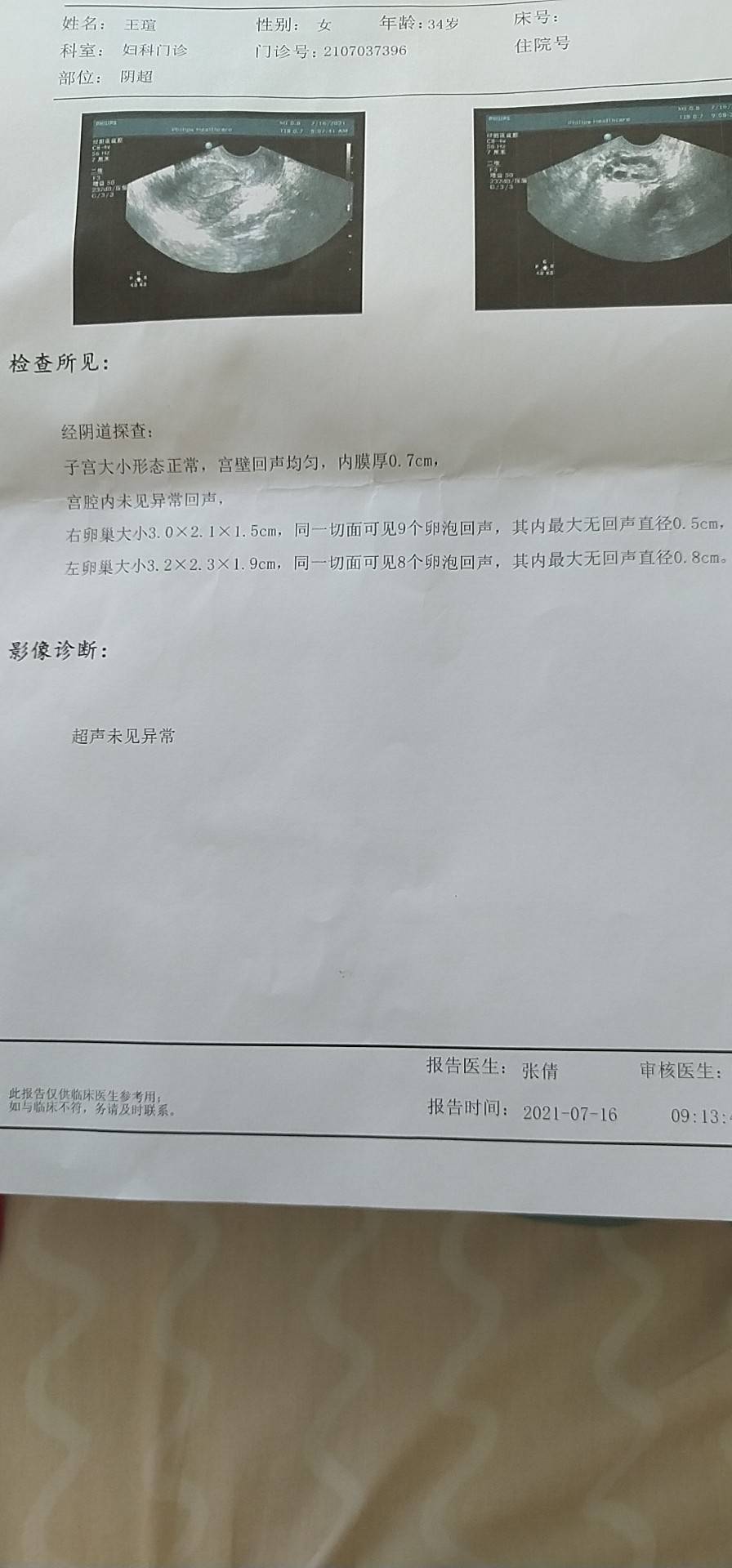 医生好本人女34岁今年4月开始备孕当月16日