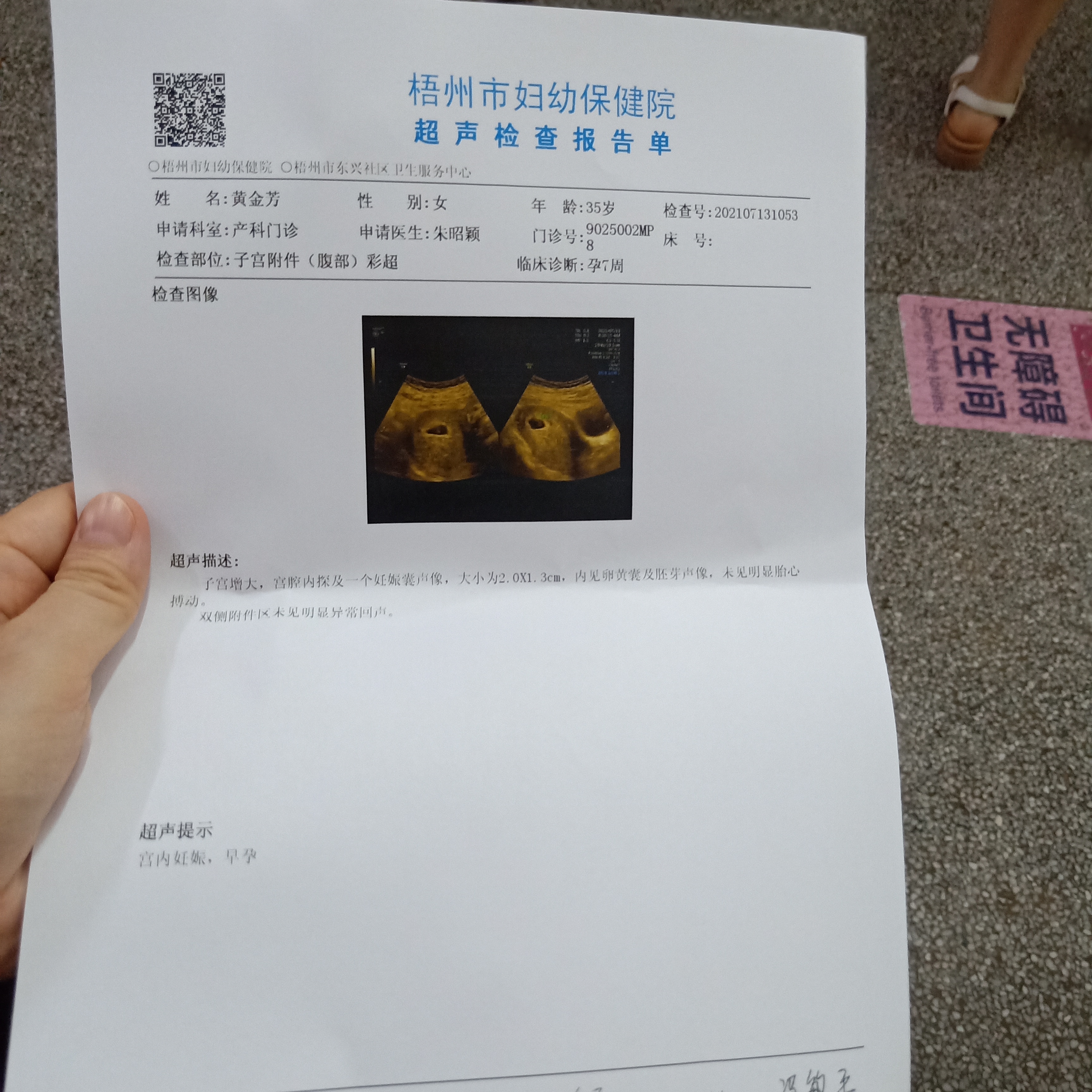 末次月经4月27号周期大概50天5月25号测