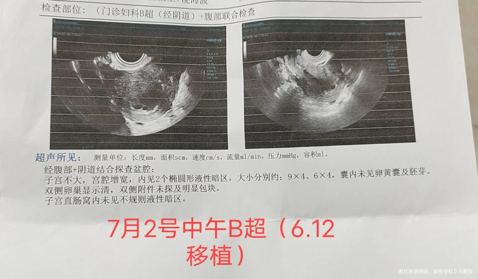612移植2号和5号都做了B超孕囊相差甚远请