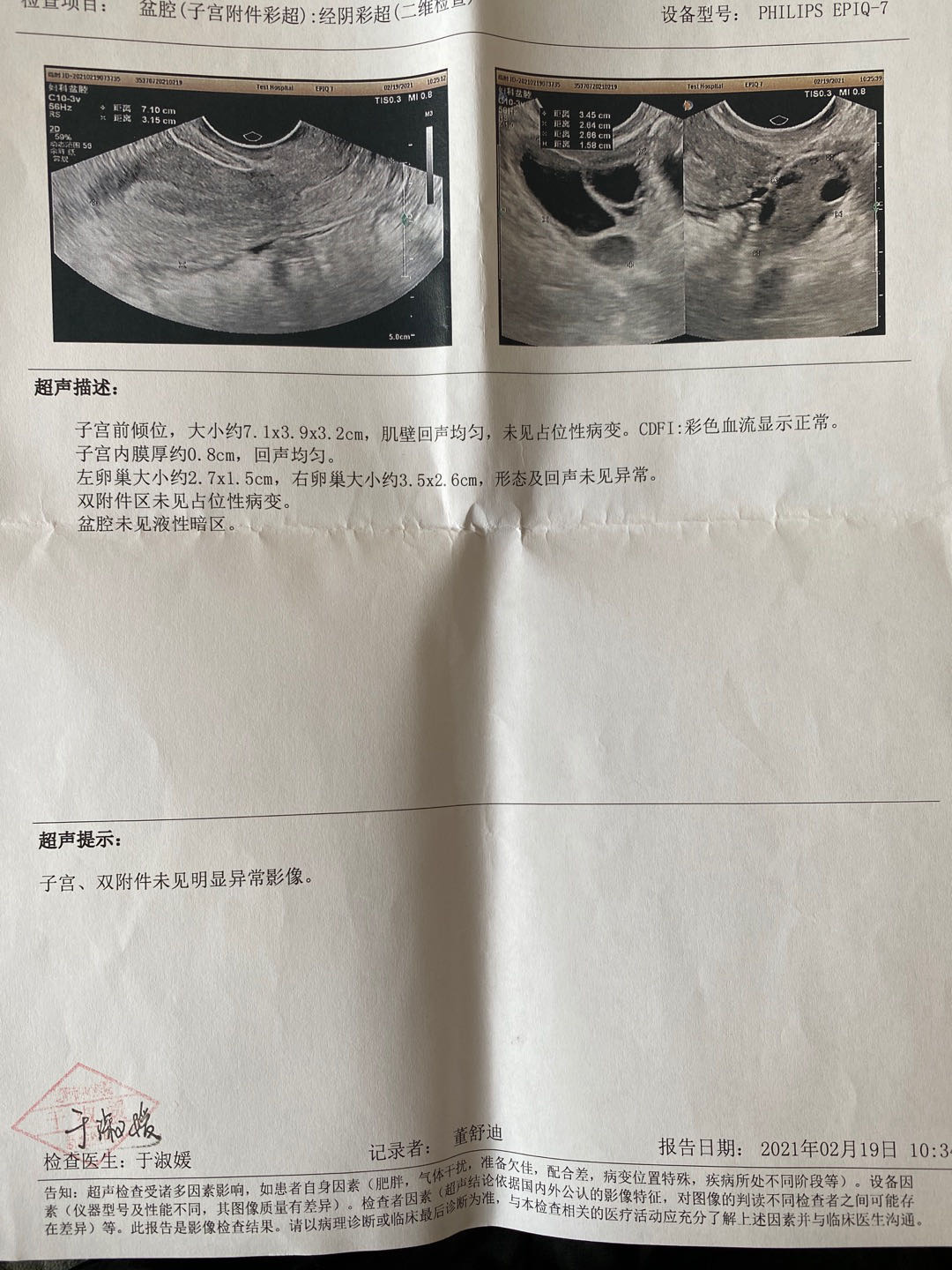 您好这个是2月份做的检查到现在一直迟迟没要上