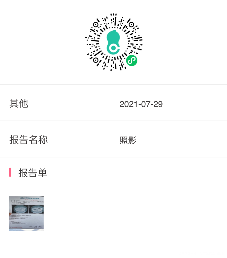 试管医生建议做结扎从没有生过不想结扎怎么办