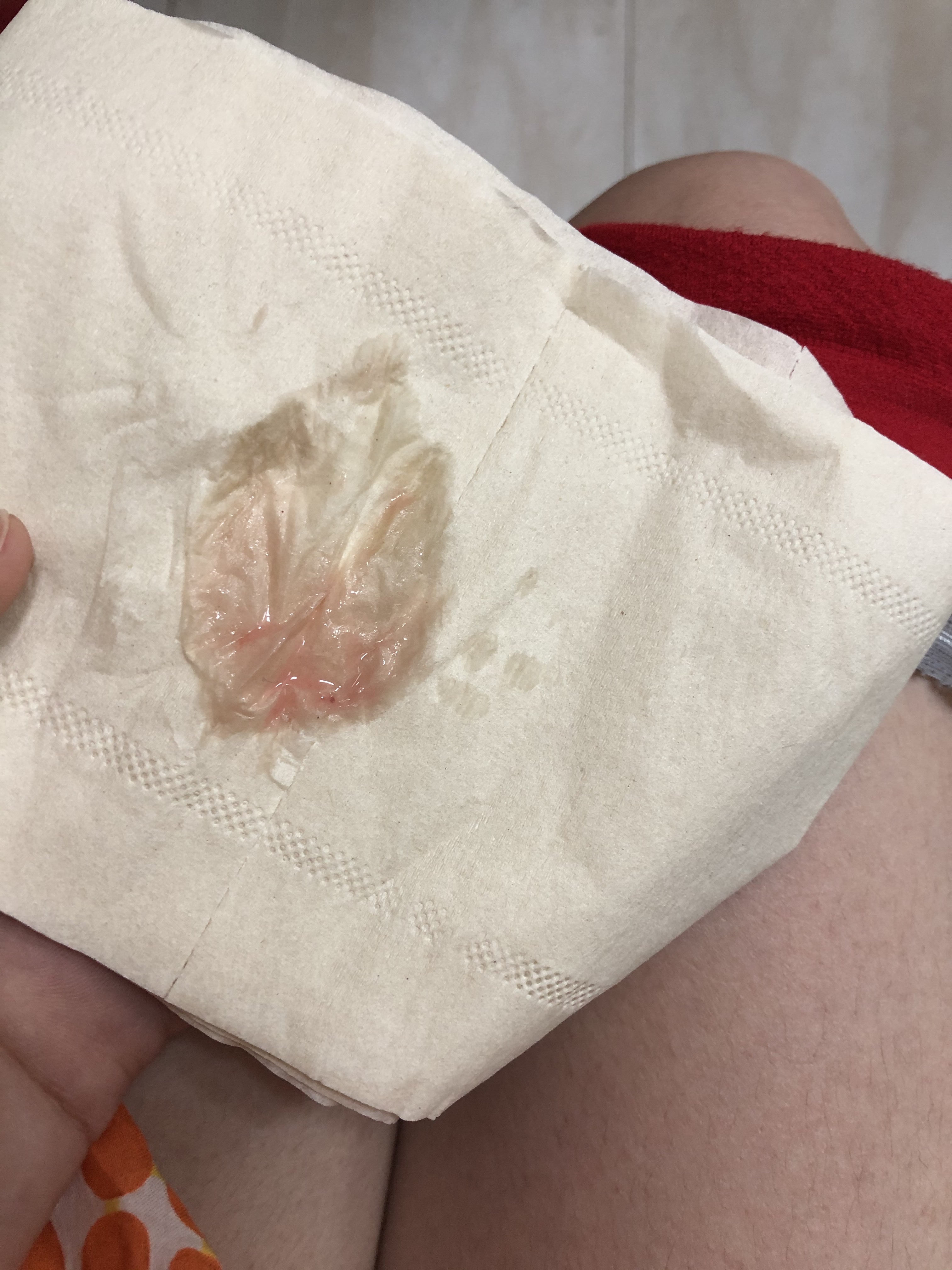 这是来大姨妈了吗……