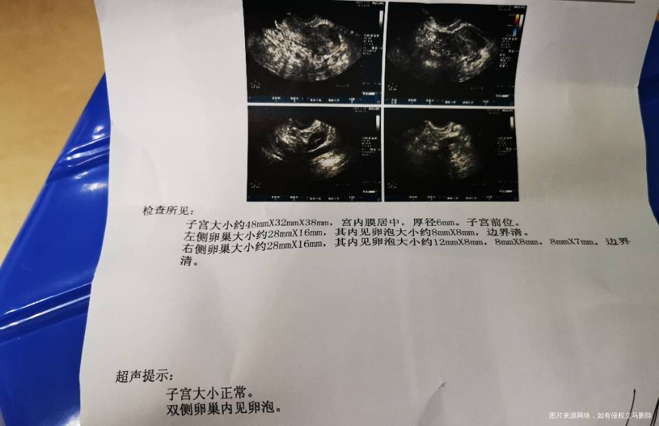 刚才做的阴道彩超看看卵巢多囊情况发现不是多囊