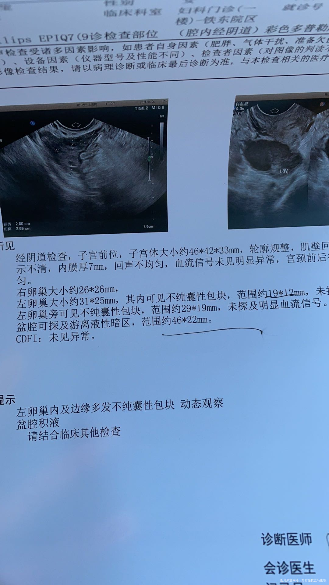 怀孕空囊4月22日做了手术4月30号复查彩超