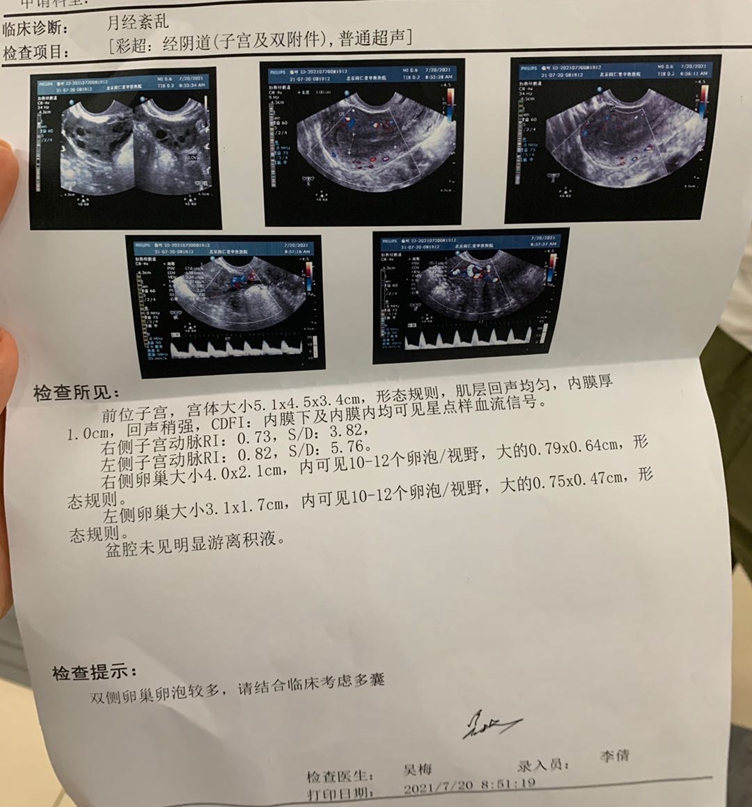 图一图二是7/20日B超检查计划于725日进