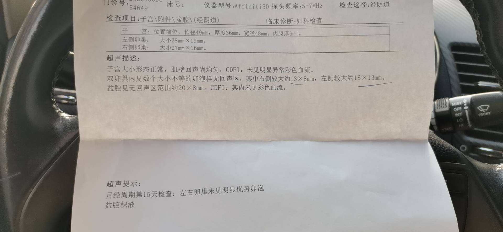 同样是今天做的阴超区别怎么那么大这是什么情况