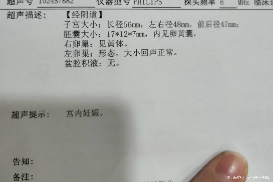 我是促排第五次怀孕的末次月经是5151965