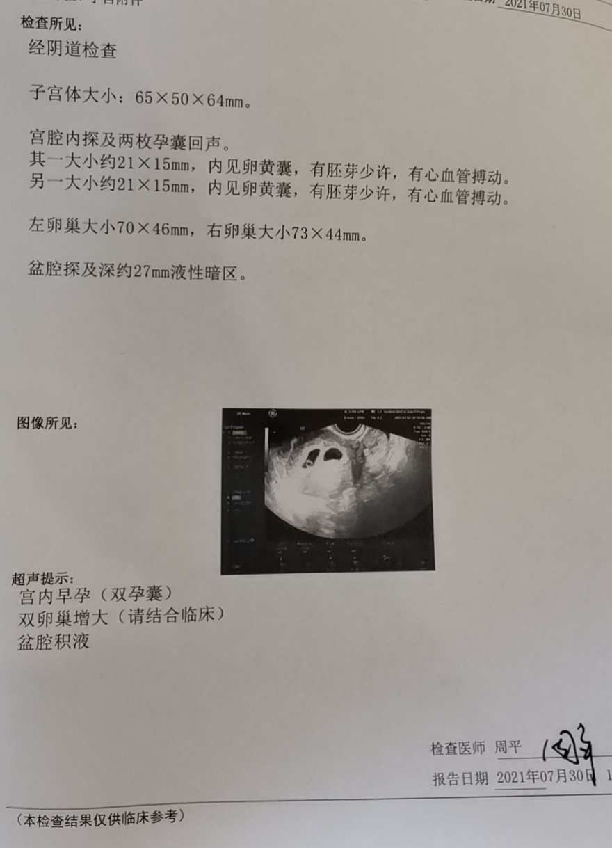 73移植今天提前一超因为药快用完了今天刚查二