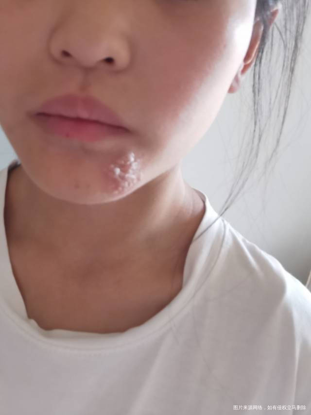 嘴角起来这些泡泡不知道是啥东西