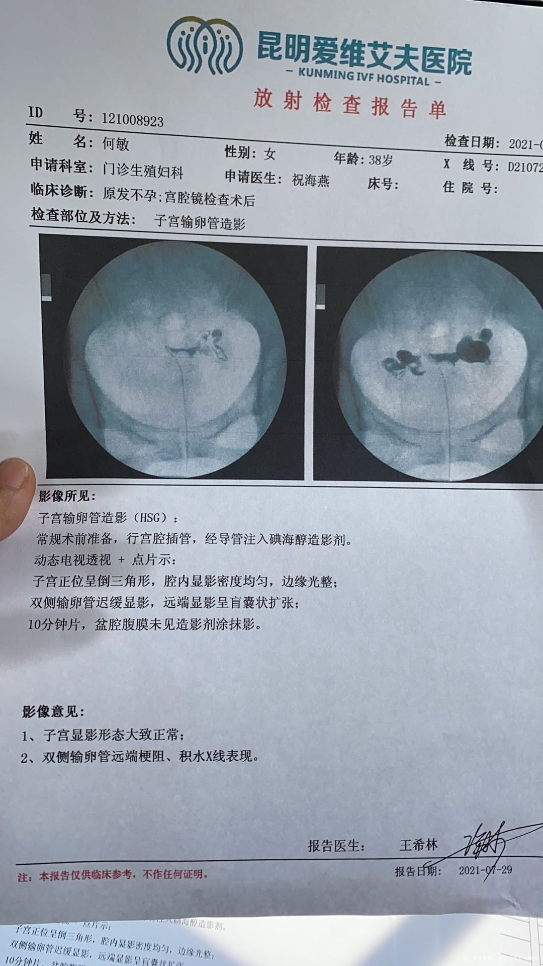 试管医生建议做结扎从没有生过不想结扎怎么办