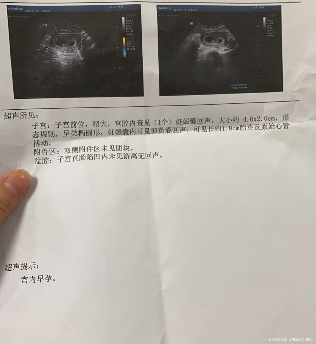 怀孕两个月了今天前几天肚子一直胀痛今天做了个