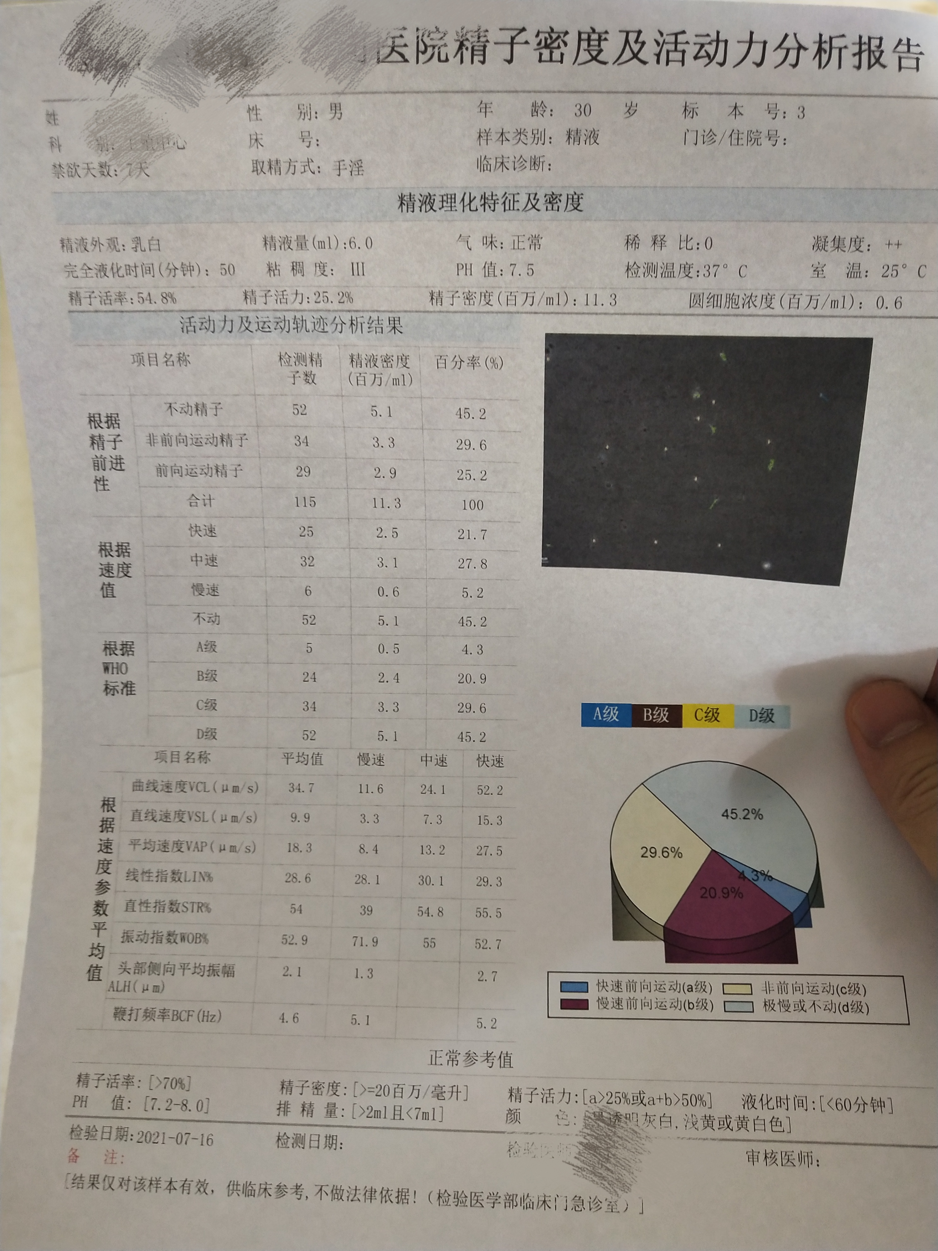 麻烦看看我的精液报告弱精少精严重吗怎么治疗谢