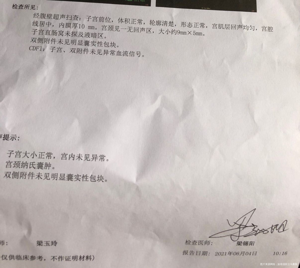 备孕两个月都没成功想看下有没有什么问题