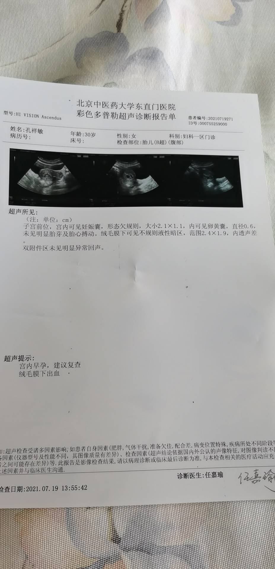 医生您好我末次月经是6月6号开始的8号结束的