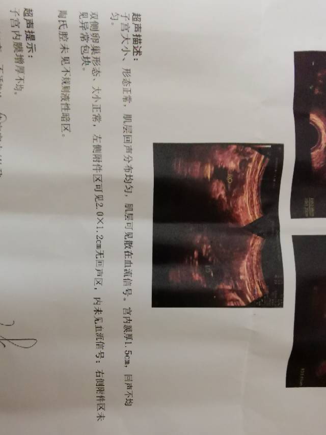 末次月经5月24日6月19日开始少量阴道流血