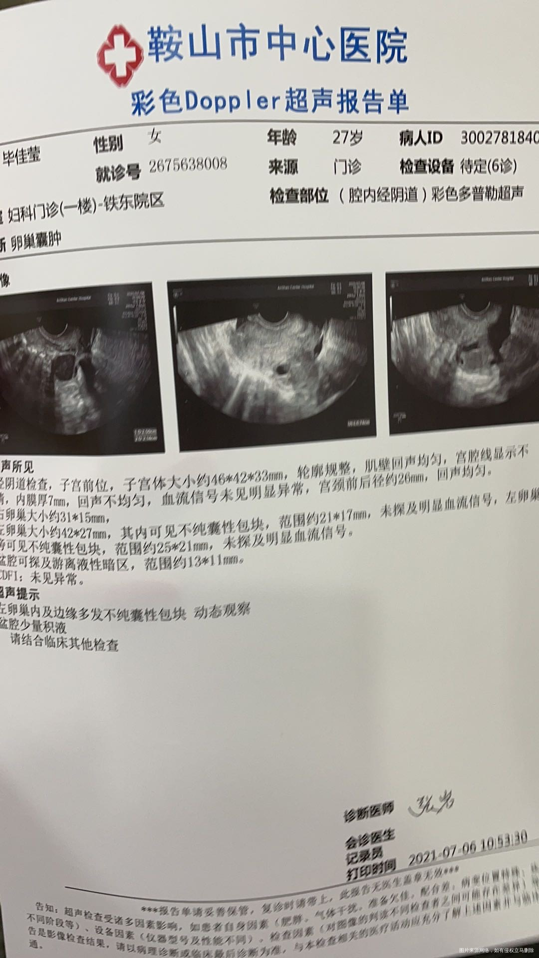 怀孕空囊4月22日做了手术4月30号复查彩超