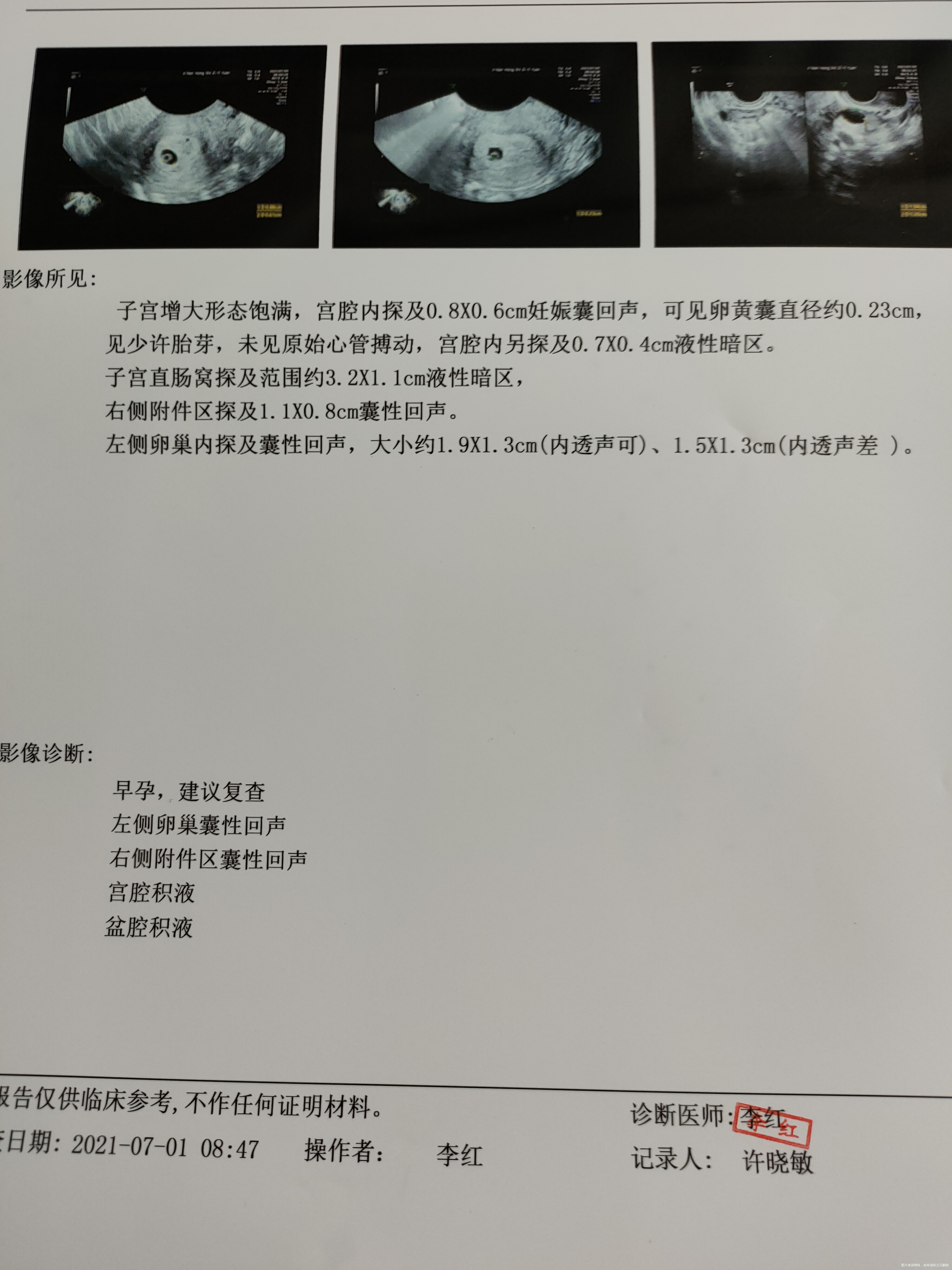 医生你好昨天我去医院检查刚有点胎芽医生建议做