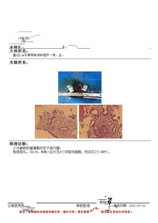 监测卵泡发现内膜囊性增生然后行宫腔镜检查报告