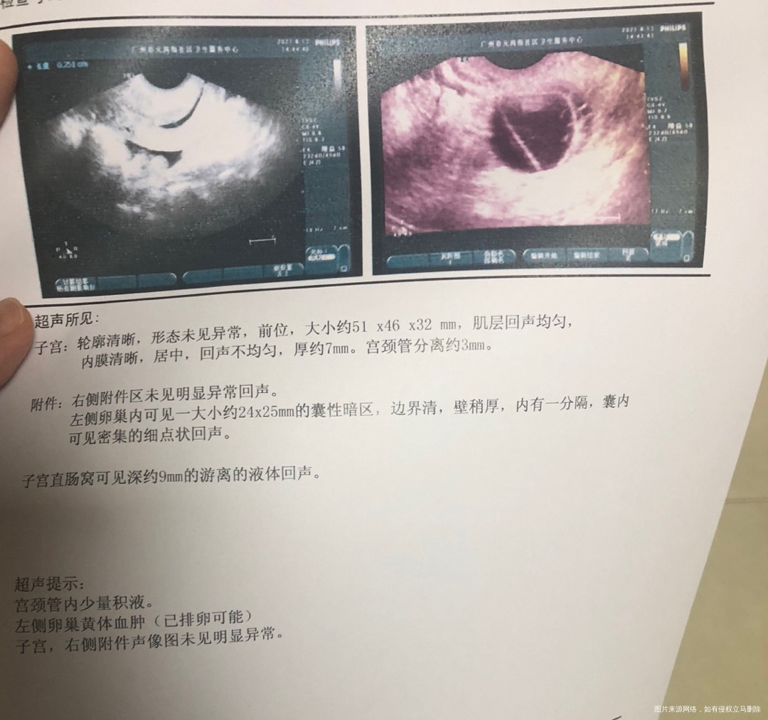 623刮宫729来姨妈813早上10点排卵试