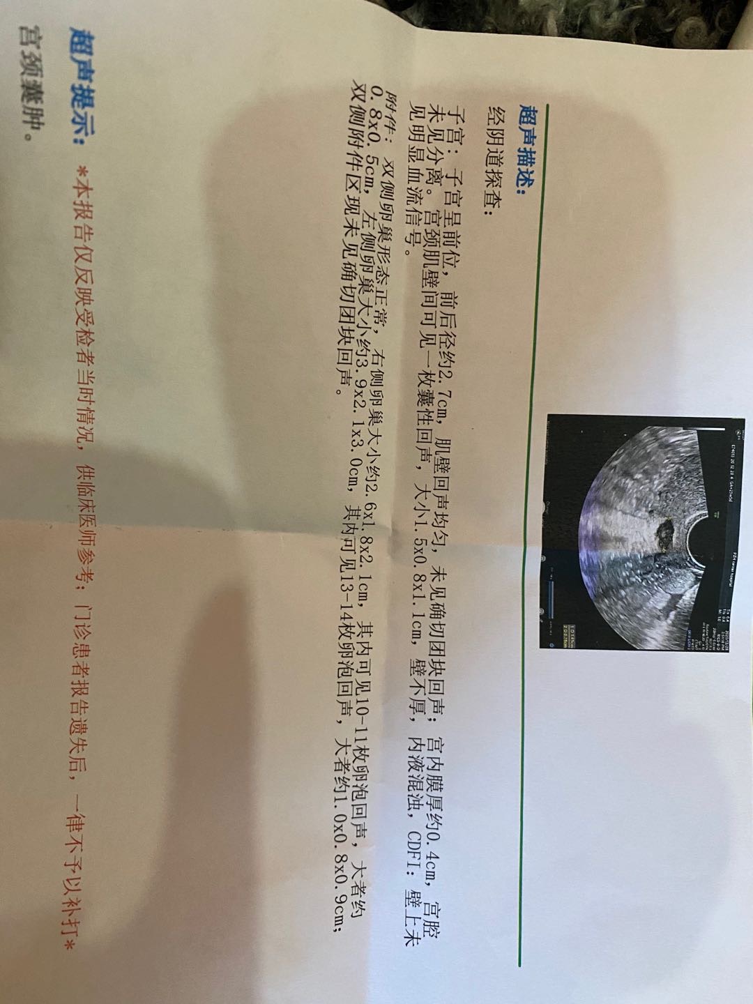 从第一次来月经到现在我的月经一直都是不规律的