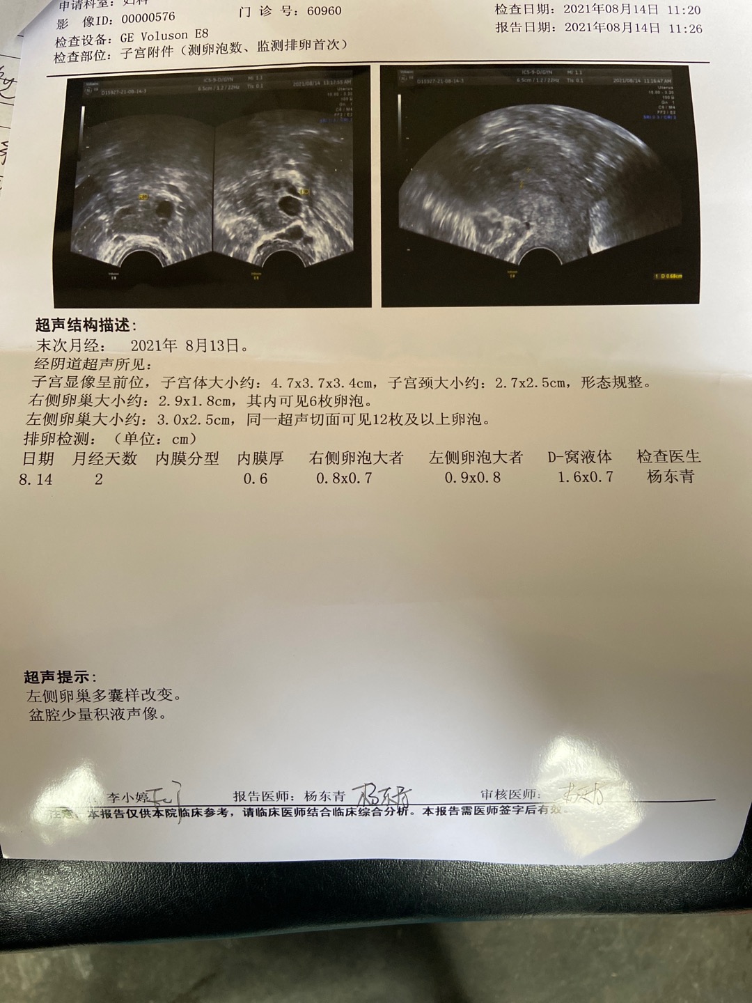 上个月吃了一个月达英35以前双侧多囊这个月左