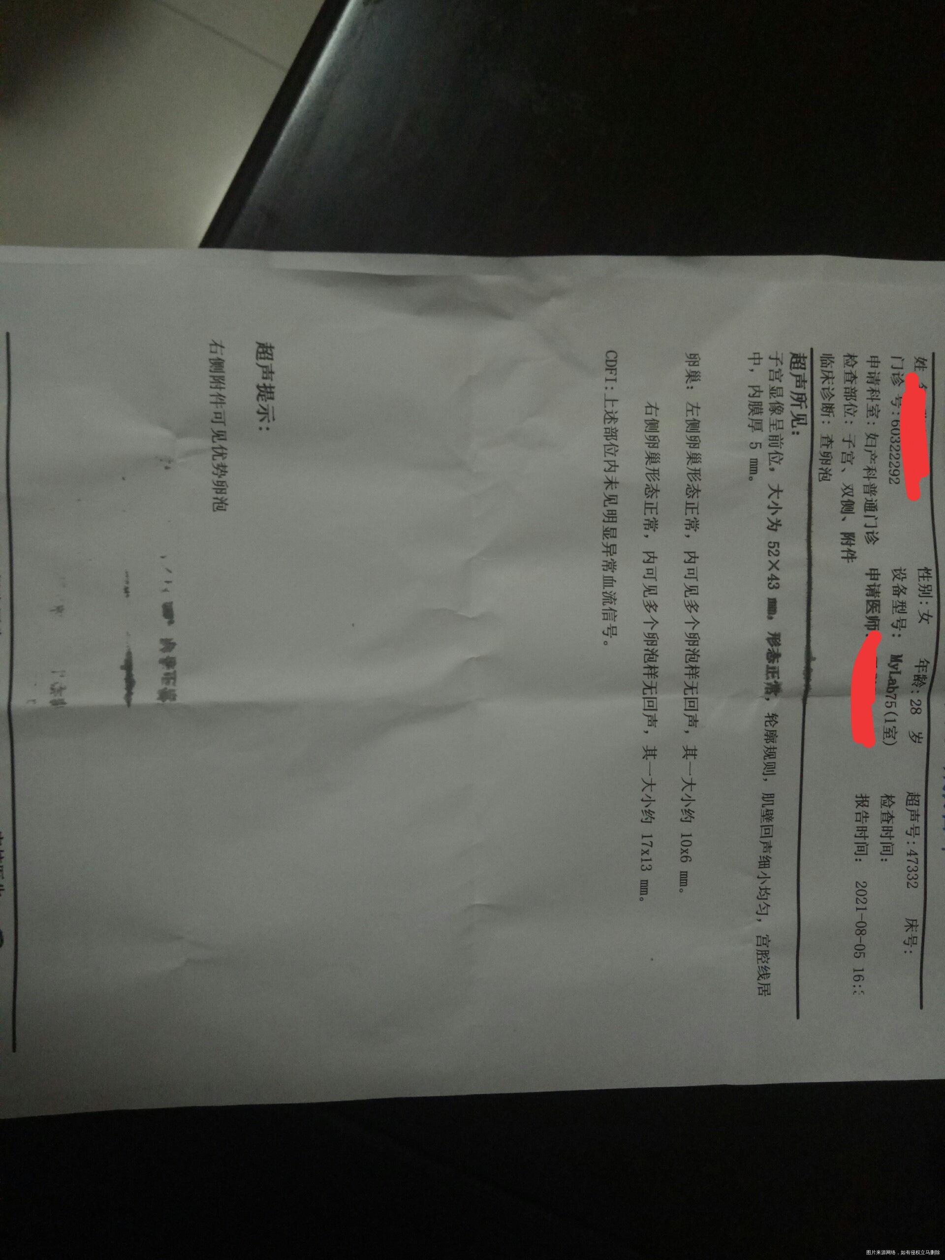 多囊性激素正常甲状腺也正常月经一般都很规律两