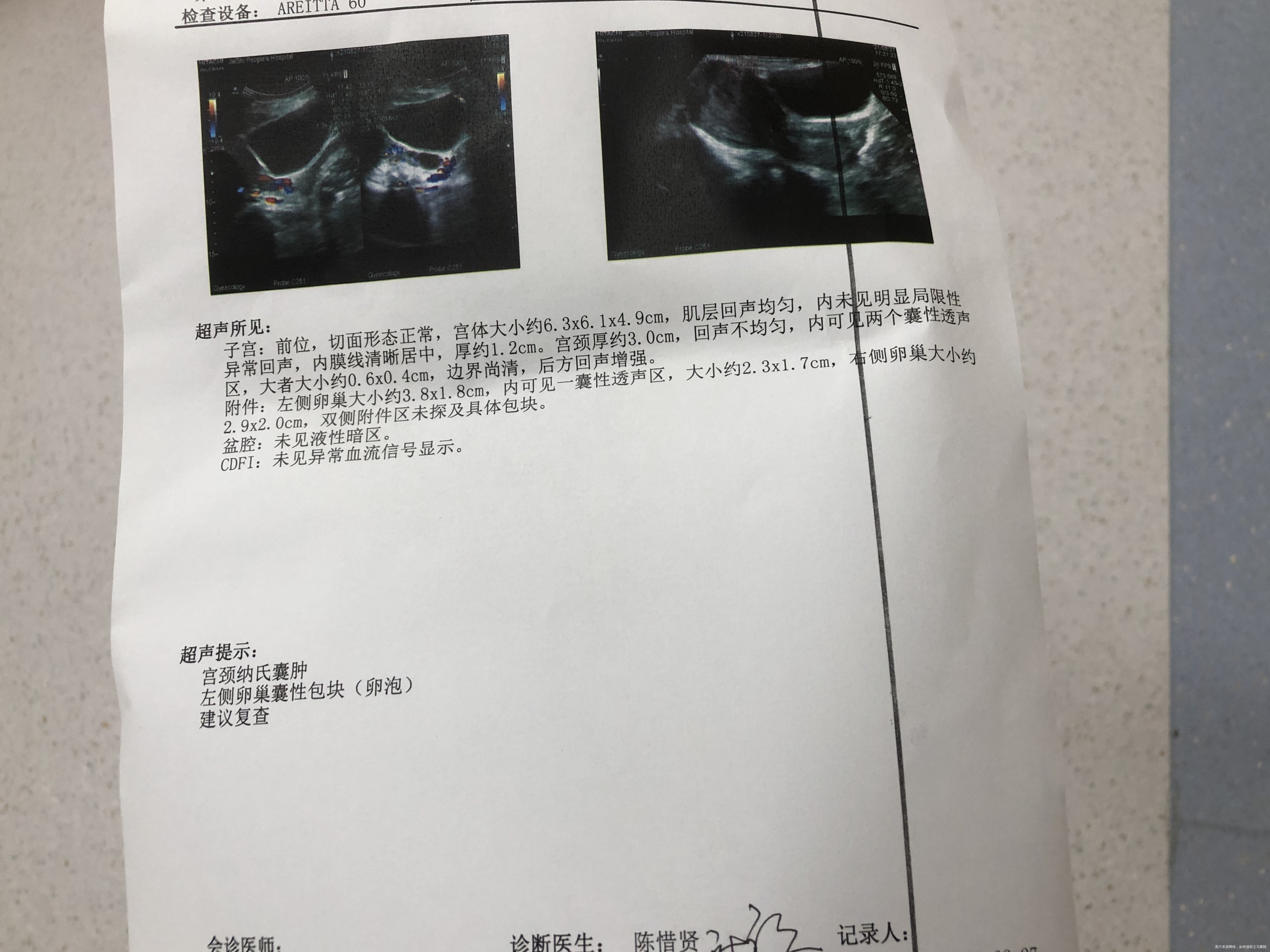 月经第十二天卵泡23✖️17cm正常吗第二张