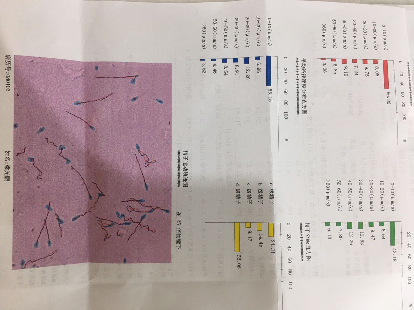 医生这个精子报告质量怎么样能自然怀孕吗