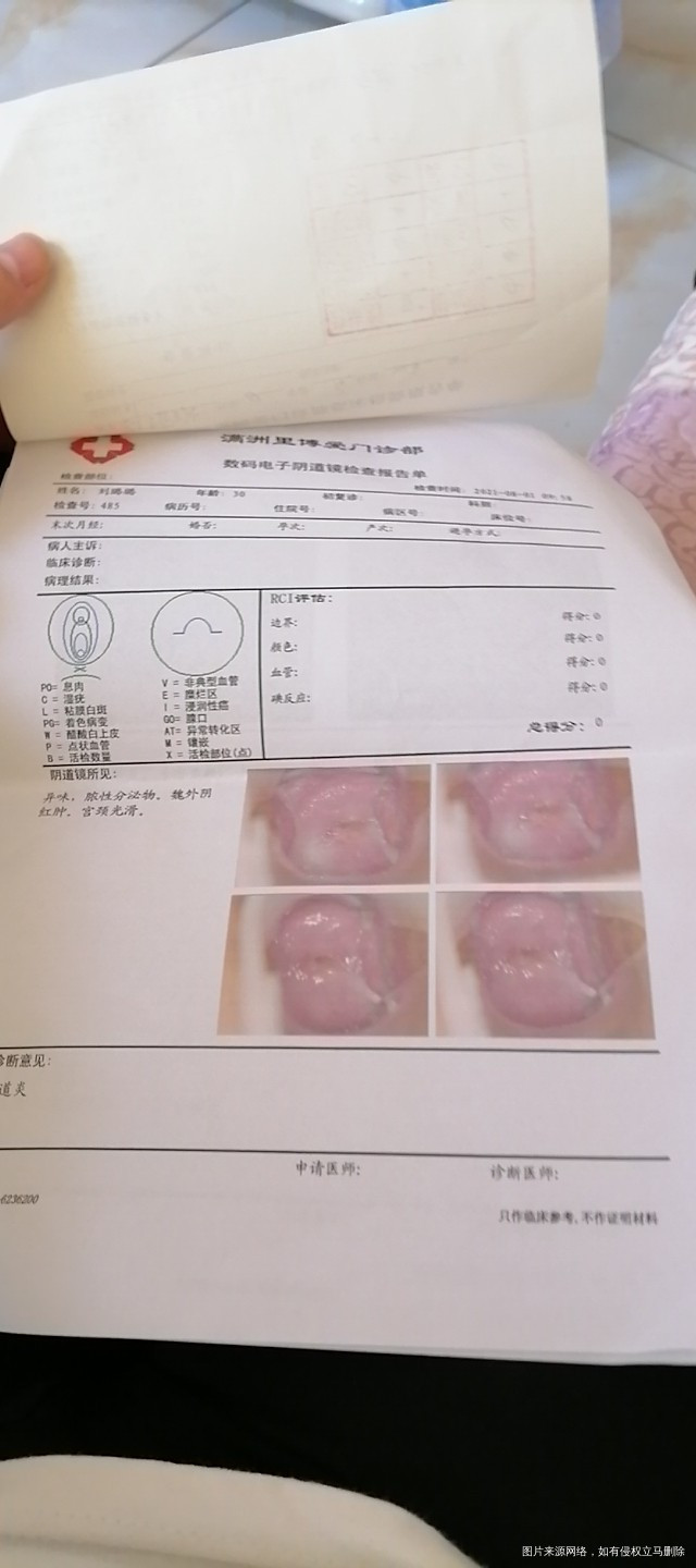 小腹疼痛下体瘙痒有异味白带多外阴道红肿热痛